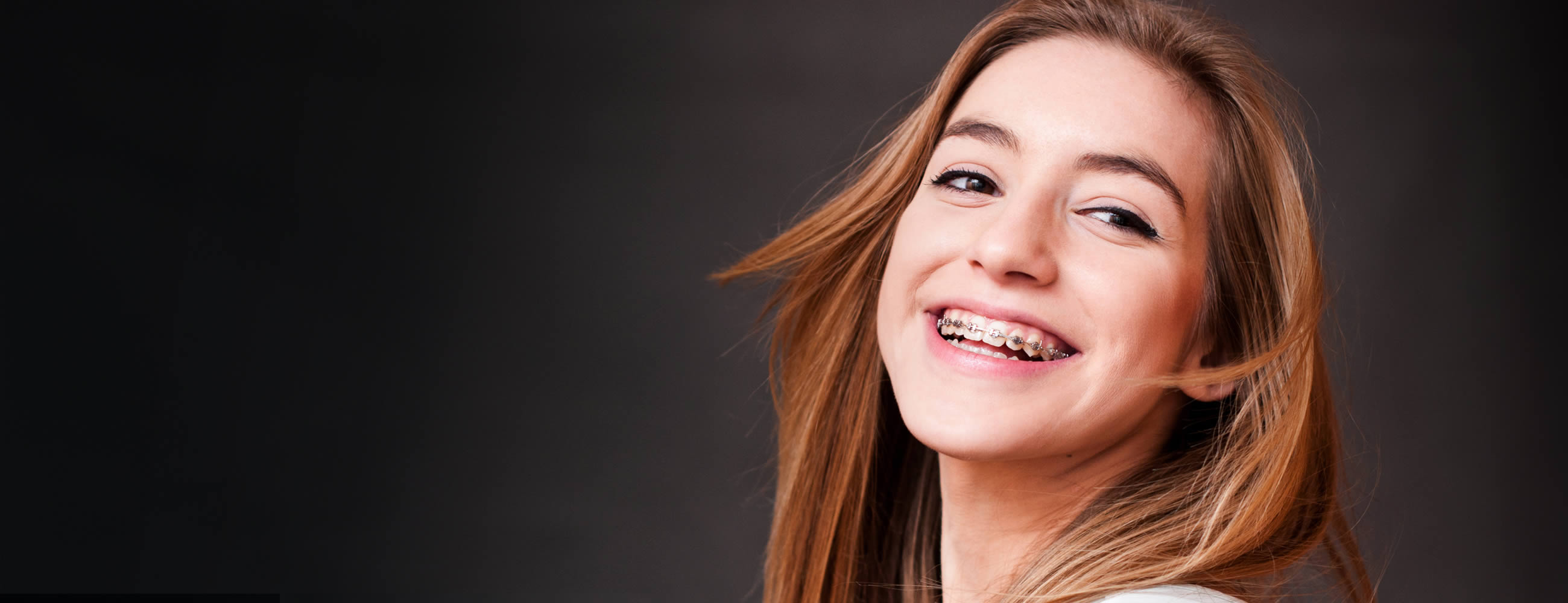 Orthodontic Treatments in Soho