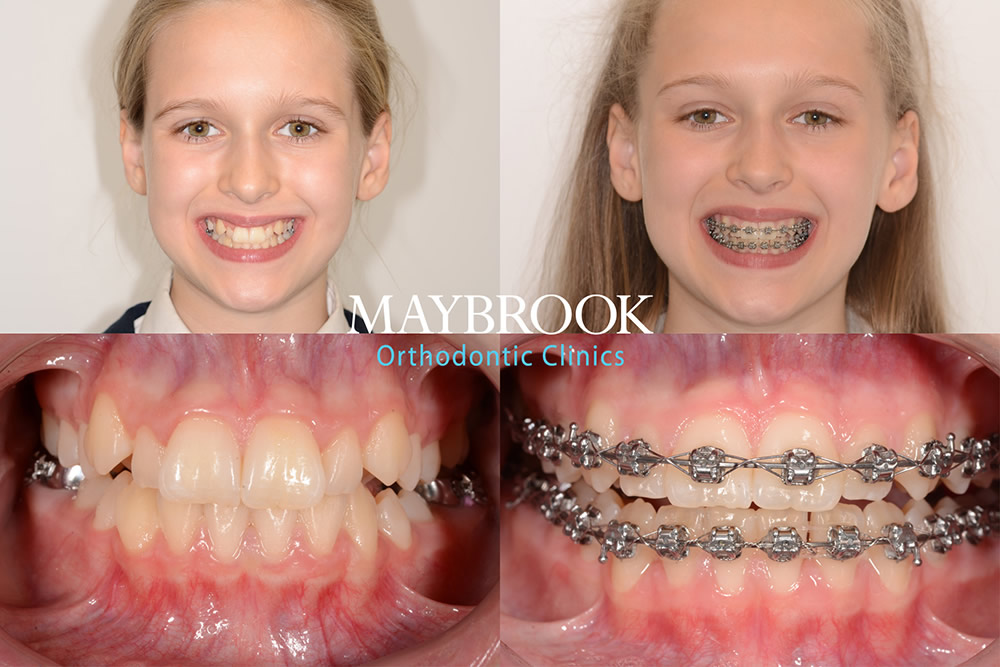 Jessica testimonial for Maybrook Clinic